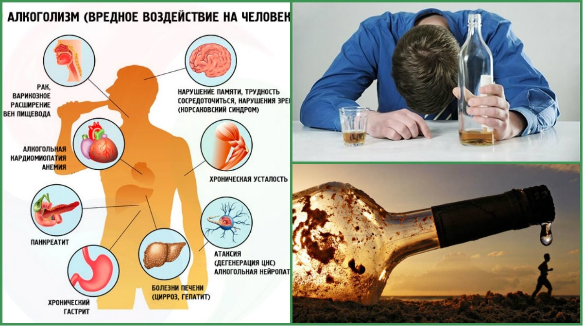 Чрезмерное употребление алкоголя